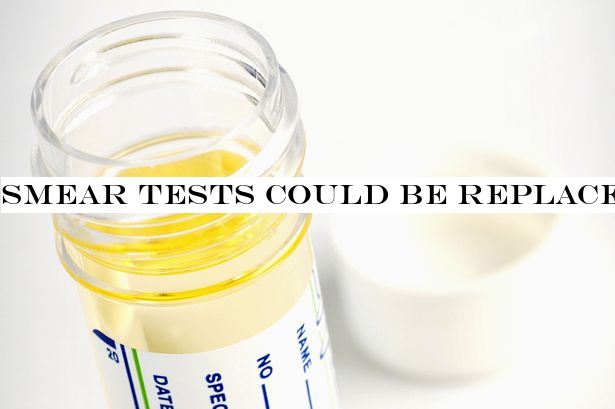 Smear tests could be replaced by at-home urine kits after major medical breakthrough