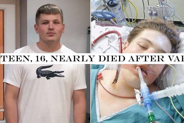 Teen, 16, nearly died after vaping for just five months 'left him on life support'