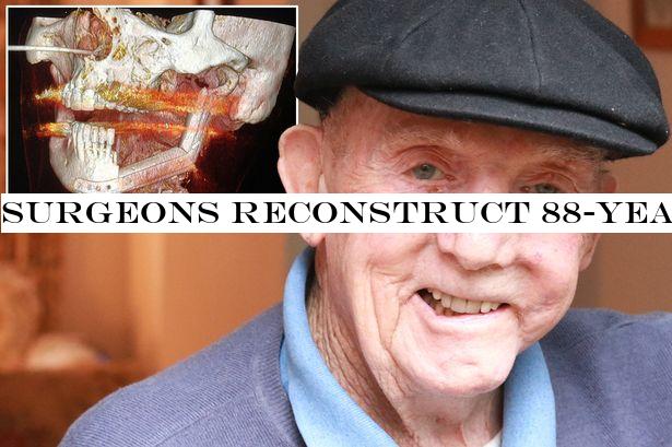 Surgeons reconstruct 88-year-old man's jaw - using a chunk of bone from his leg